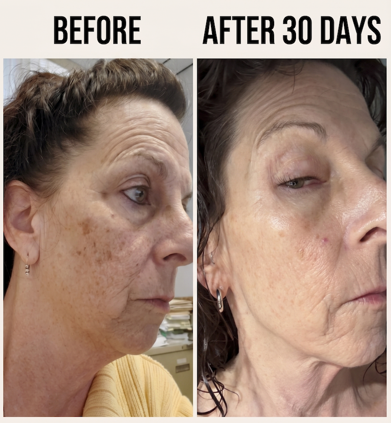 Best Korean Skincare for Hyperpigmentation – Saranghae Means I Love You
