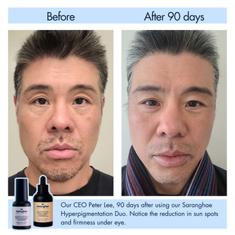 Saranghae Hyperpigmentation Duo