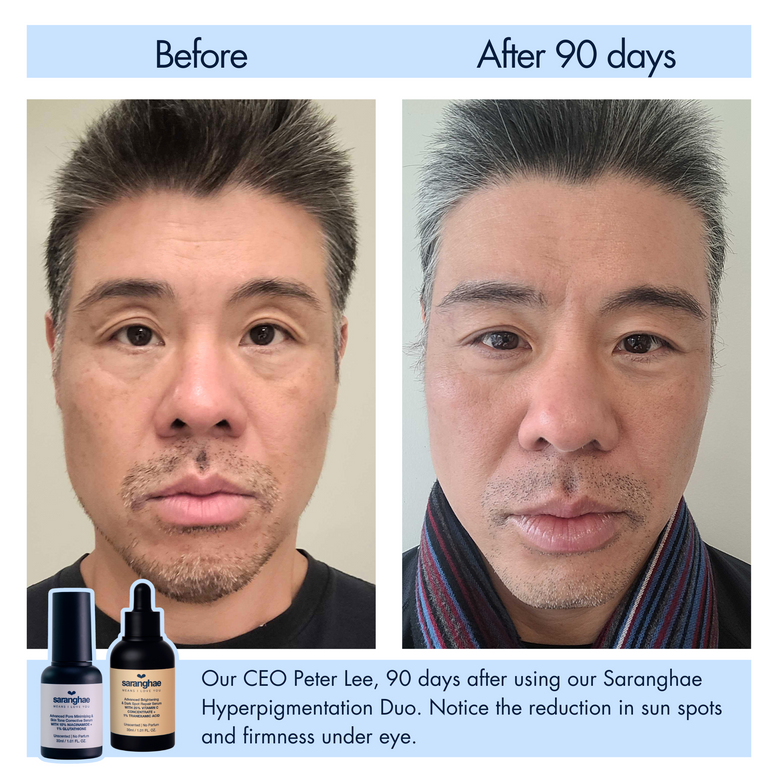 Saranghae Hyperpigmentation Duo