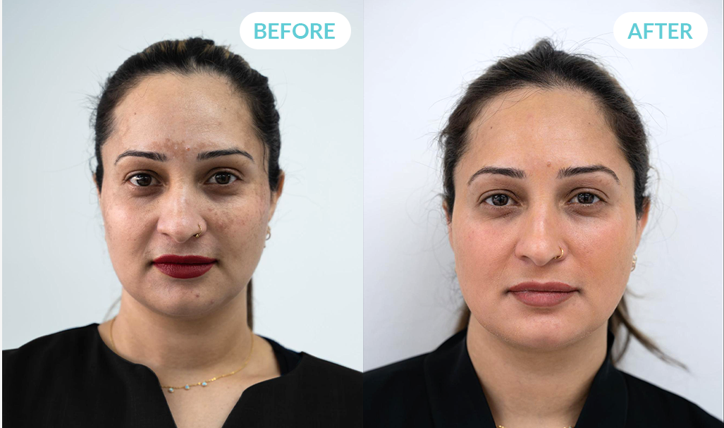 Advanced Brightening & Dark Spot Repair Serum with 25% Vitamin C + 1% Tranexamic Acid