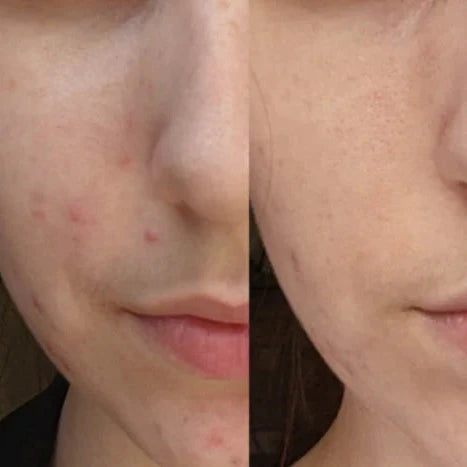 Advanced Brightening & Dark Spot Repair Serum with 25% Vitamin C + 1% Tranexamic Acid